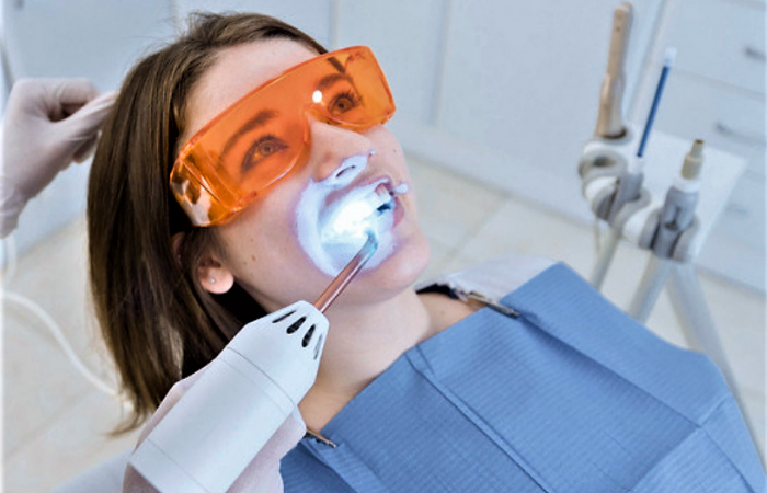 clareamento dental em consultório aldeota montese parangaba fortaleza dentista