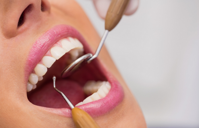 limpeza dental manutenção semestral família dentista profilaxia aplicação de flúor saúde bucal